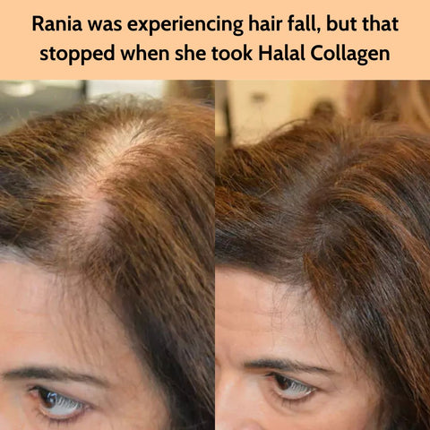 "I’m honestly shocked! After just 90 days of taking Halal Collagen, my hair has started growing back thicker and healthier. I feel so much more confident, and I’m beyond grateful for this change. I only wish I had started sooner!" - Rania