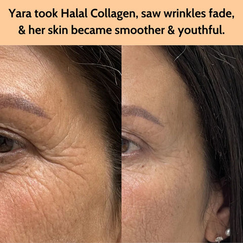 "I'm 47 and here are my results 3 months apart...The pic on the left is me at the start of my collagen journey. And on the right is me with no makeup on, unwashed face and after a long day.... clearly it's working! My hair is also starting to feel thicker! It's amazing!" - Yara
