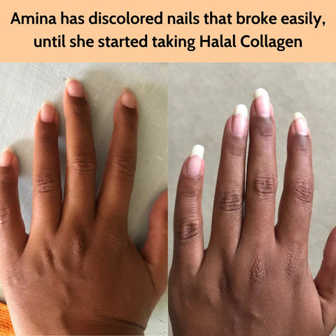 "I’ve been taking collagen for 10 weeks now, and my nails have completely transformed! They used to be weak and brittle, but now they’re stronger, grow faster, and look so much healthier. Even my friends have noticed and keep complimenting how nice they look!" - Amina